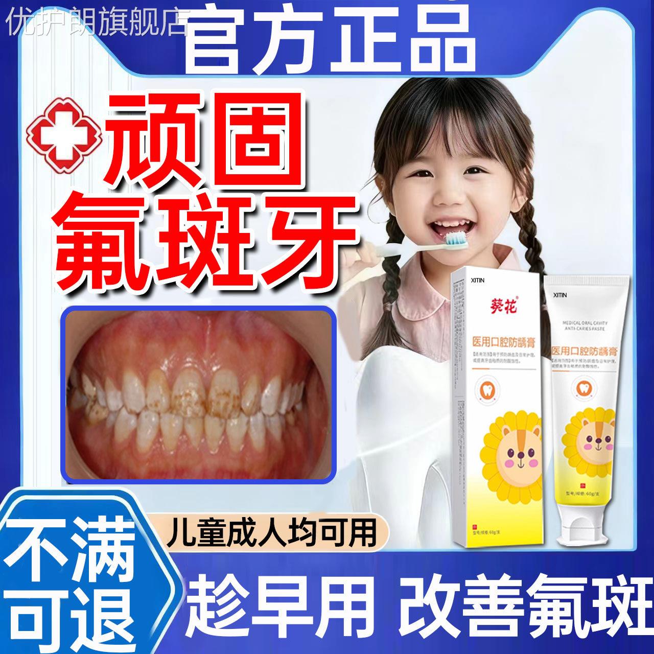 氟斑牙去除专用牙膏变白神器稀盐酸儿童牙齿白斑黄褐色祛牙菌斑PP