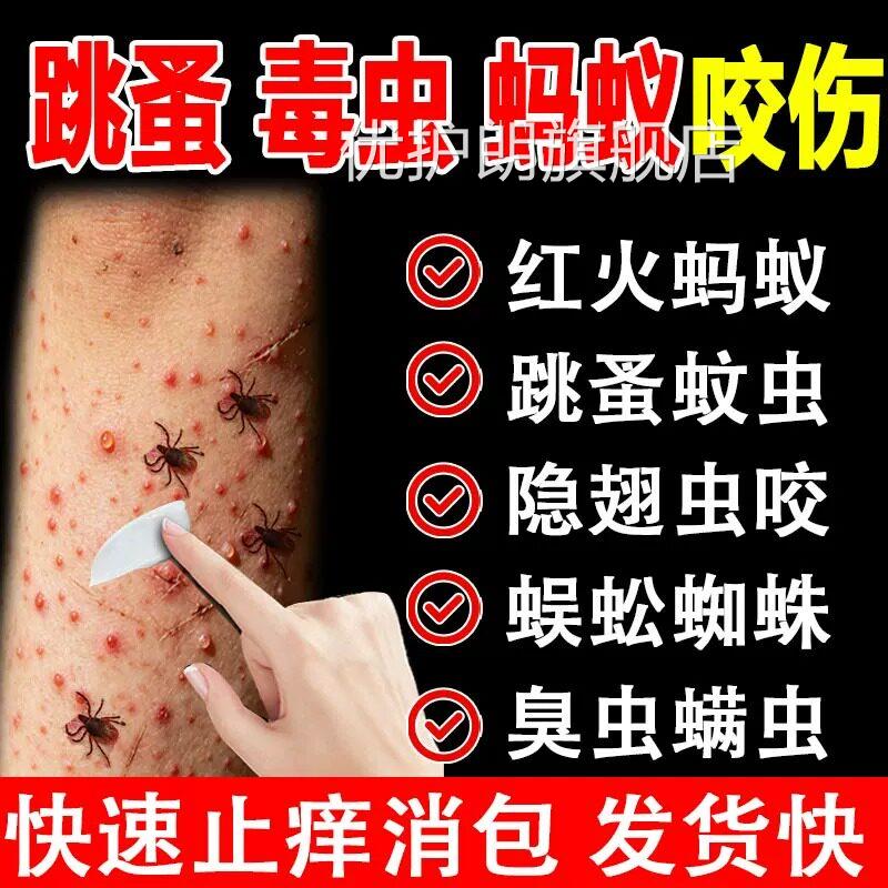 跳蚤咬止痒膏品红肿用蚂蚁咬伤膏消肿蚊虫叮咬成人儿童正官方优护