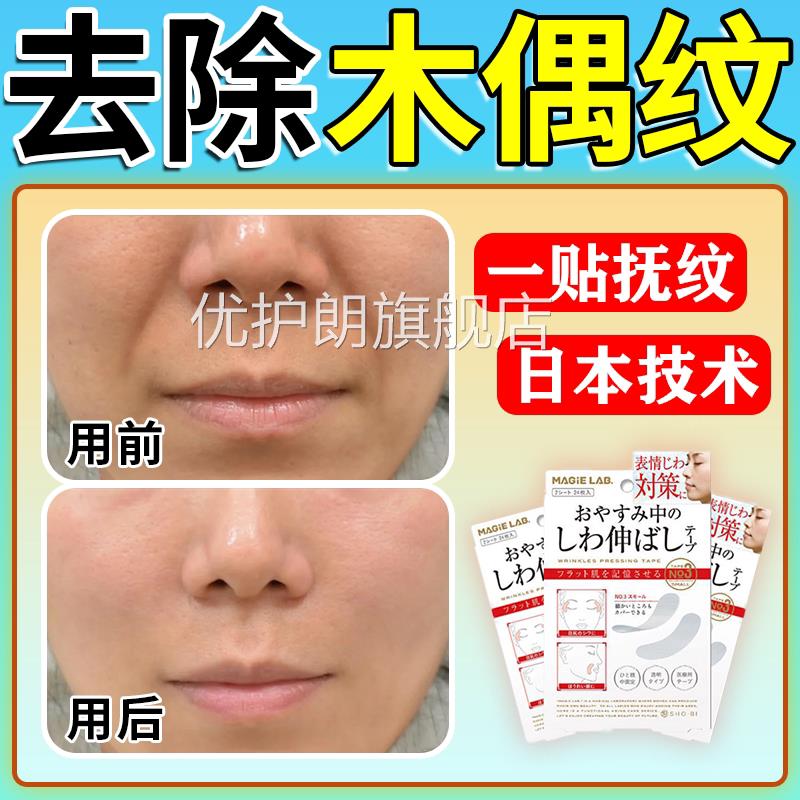 木偶纹贴去除法令纹消除神器日提拉淡化抚皱侧睡本觉专用防表情贴