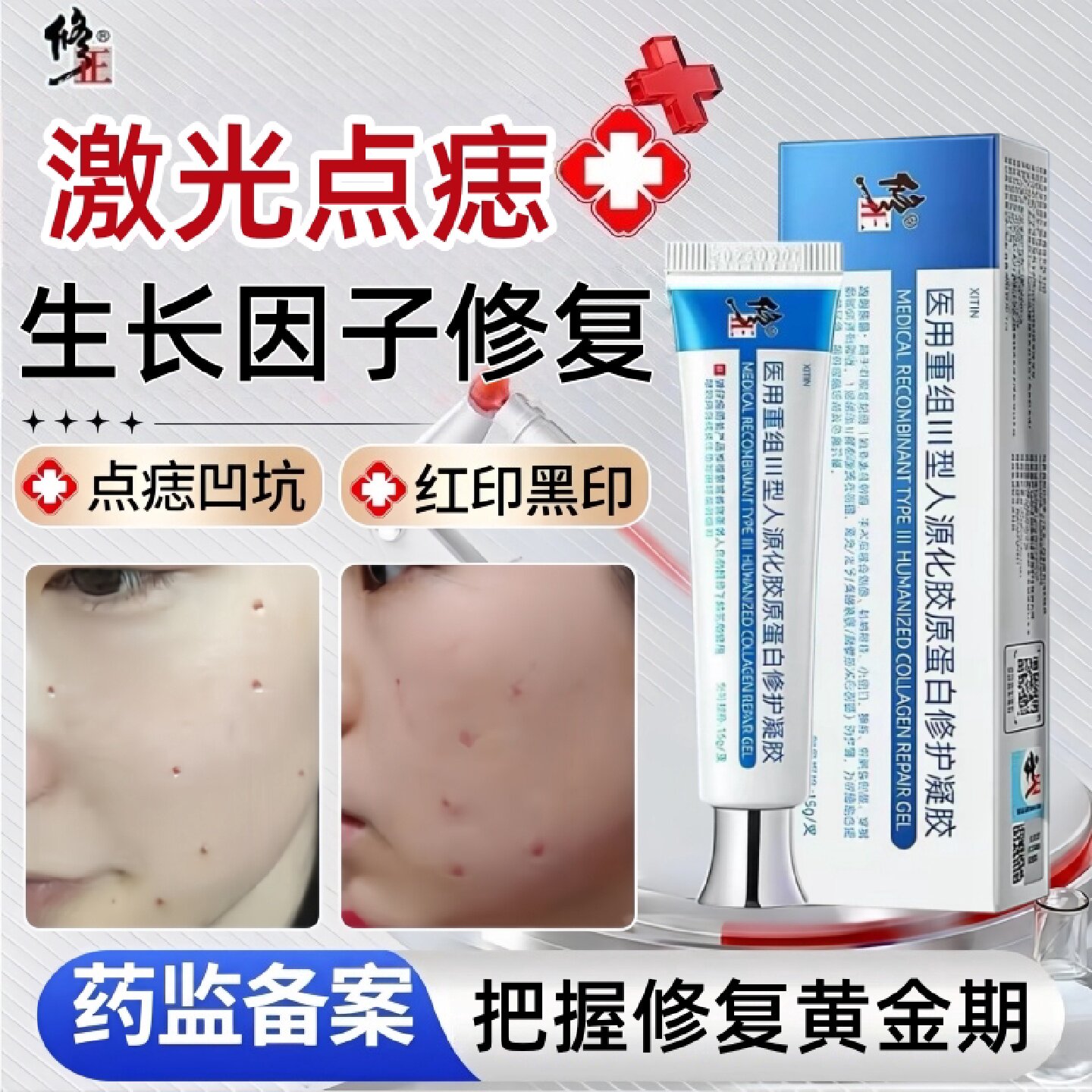 激光点痣点斑后凹陷疤痕修复膏去红印增生黑色素沉淀生长因子旗舰