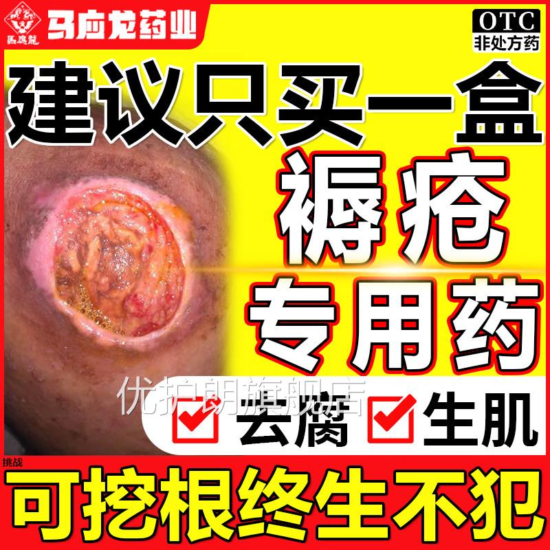 褥药膏老人臀部外用伤口愈合促进长肉生肌压疮疮皮肤溃烂非特效QF