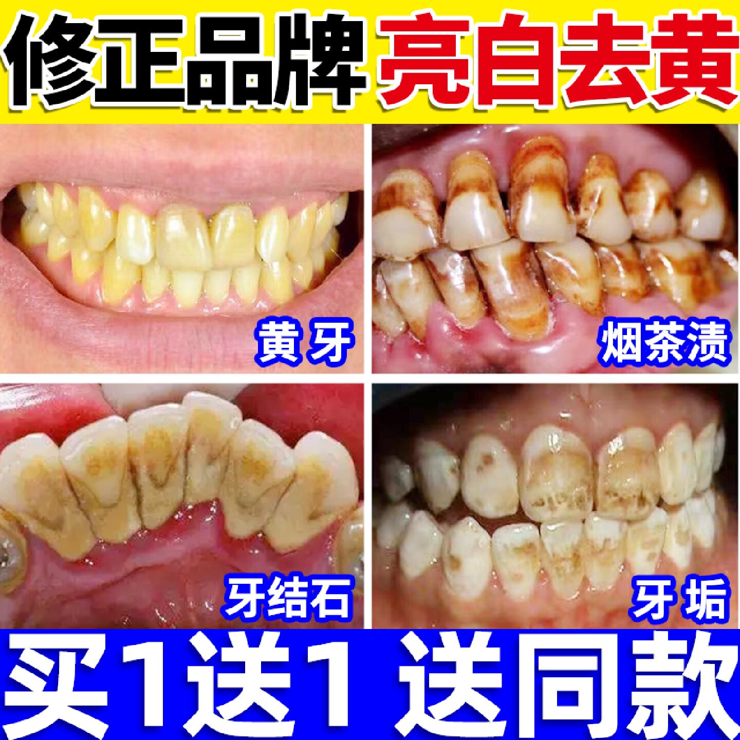 洁牙粉可搭去黄洗白牙齿美白黄牙洗污垢去牙结石神器除牙垢牙旗舰