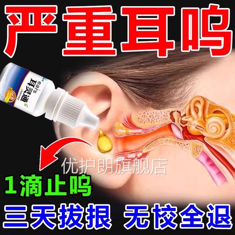 耳鸣专王用药耳鸣神经性耳鸣克星耳朵嗡嗡响耳鸣贴克星专用滴耳液