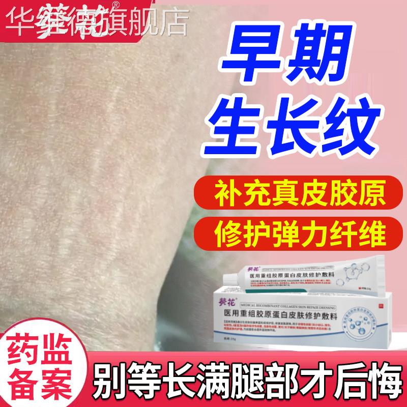 生长纹修复膏霜去除肥胖纹消除大腿上淡化专用儿童青少年学生华维
