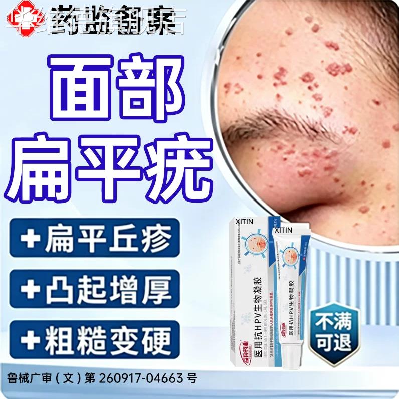 医用祛疣瘊丝状疣扁平疣去小肉粒去除膏一抹灵面颈部专用膏hpvUU