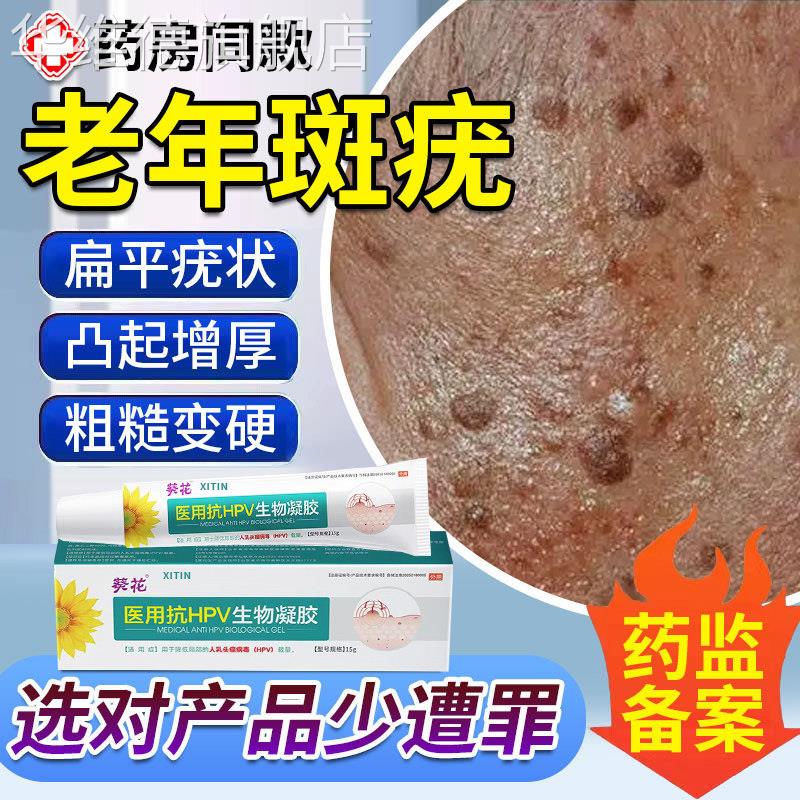 脸上扁平疣专用老年斑增厚凸起老人疣一抹灵专用脸部黑斑去除膏UU