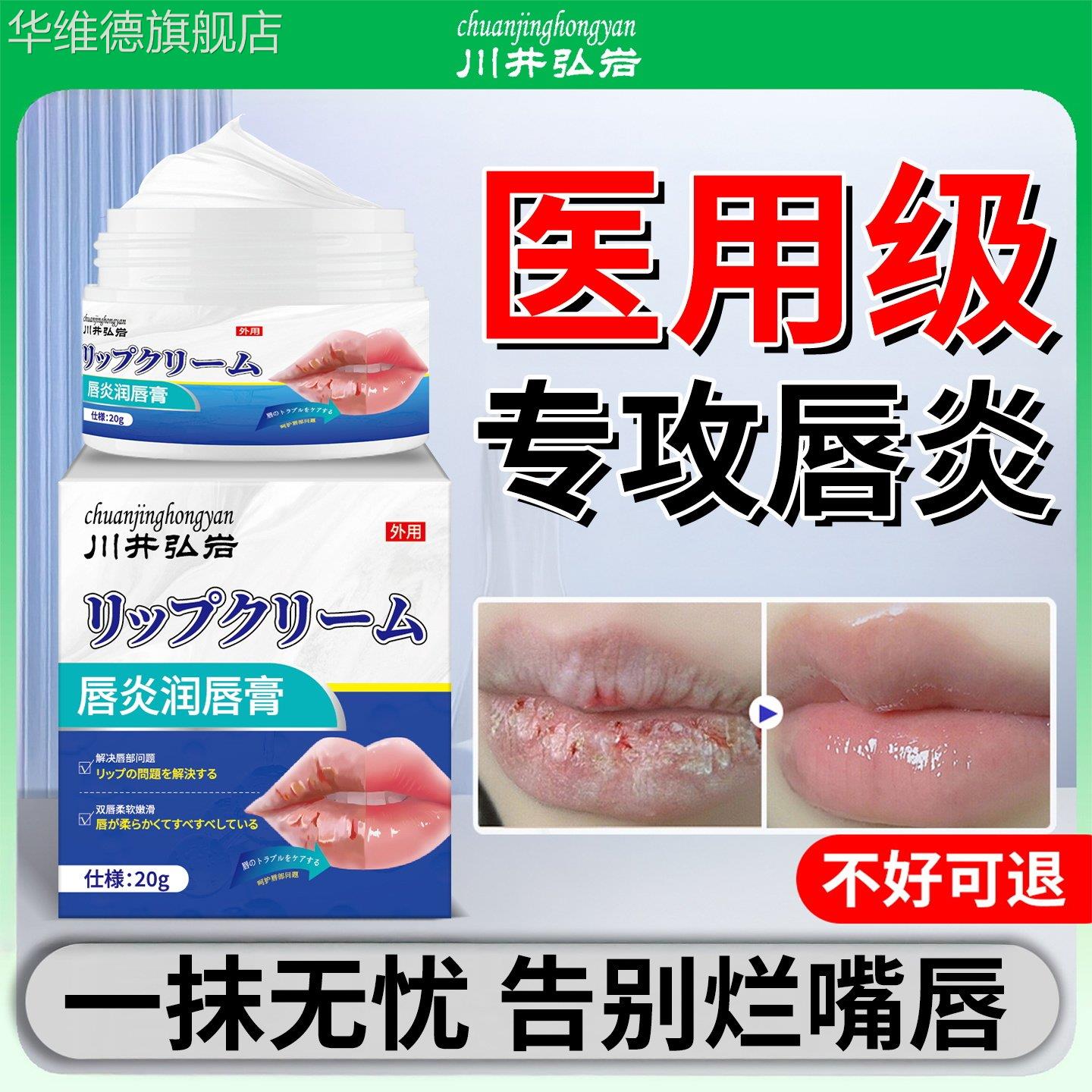 唇炎唇膏润嘴唇干裂脱皮保湿滋润去死皮医用口角炎疱疹剥落性修护