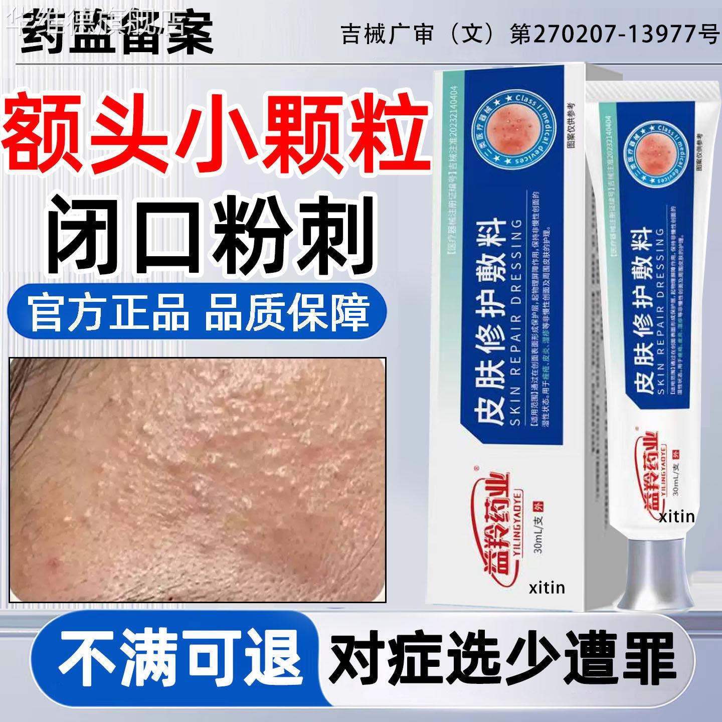 逆光疹修复脸上起小疙瘩儿童面部去闭口粉刺小颗粒屏障受损药膏LT