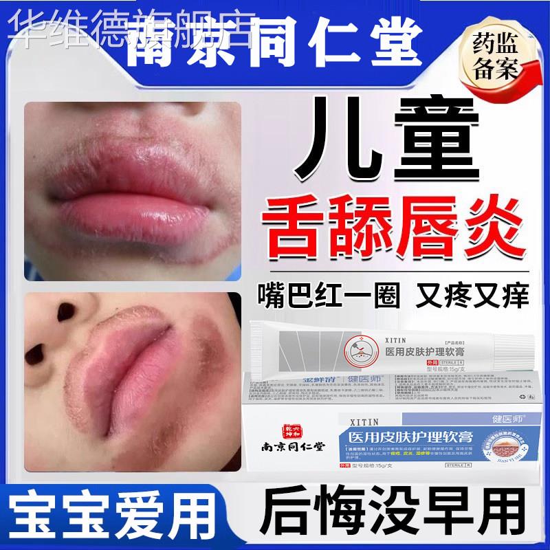 儿童舌舔唇炎专用唇膏嘴唇防干裂脱皮嘴巴一圈红医用型凝胶嘴角LL