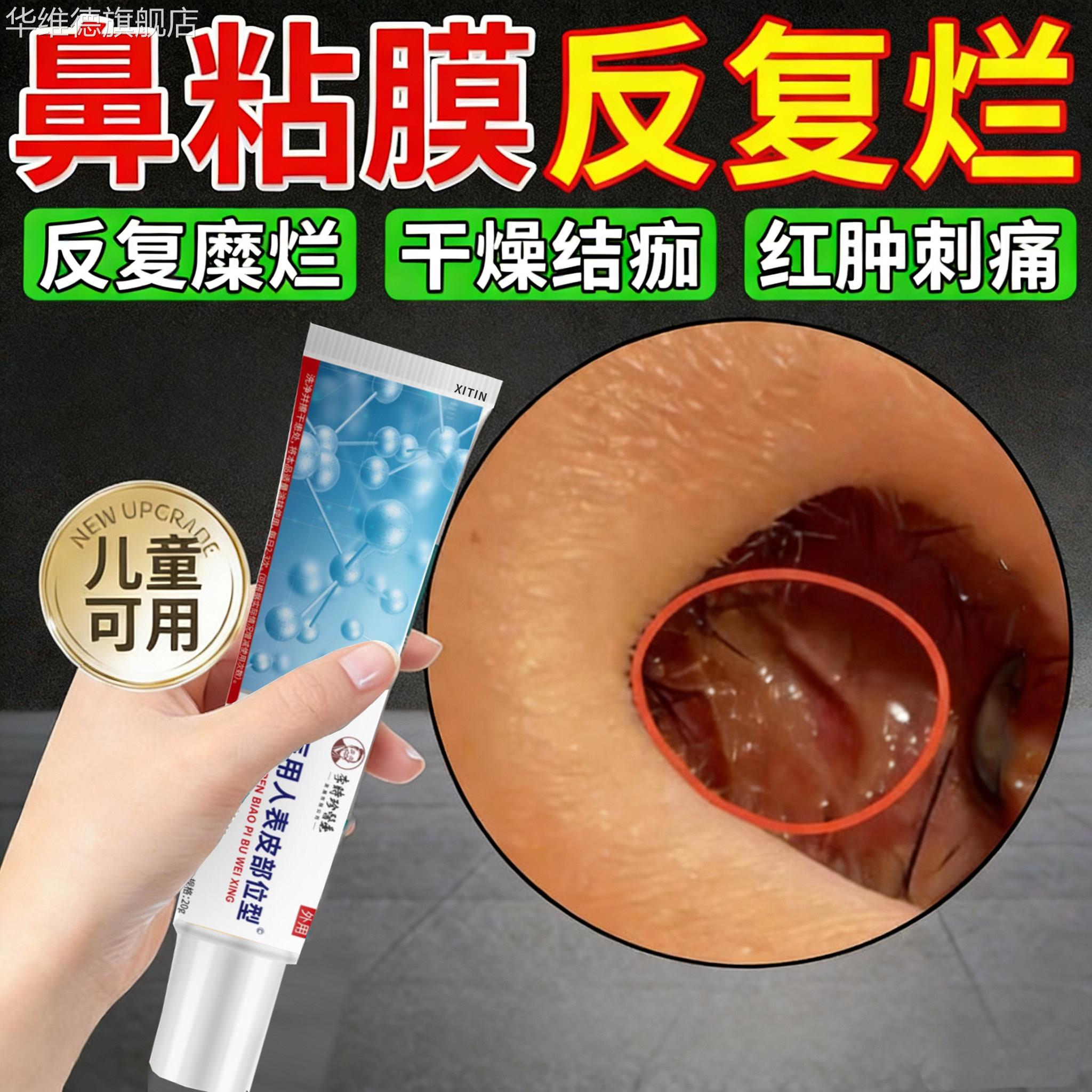 鼻中隔鼻腔溃疡上火鼻子生疮结痂鼻黏膜糜烂干燥性鼻炎修复药膏PP