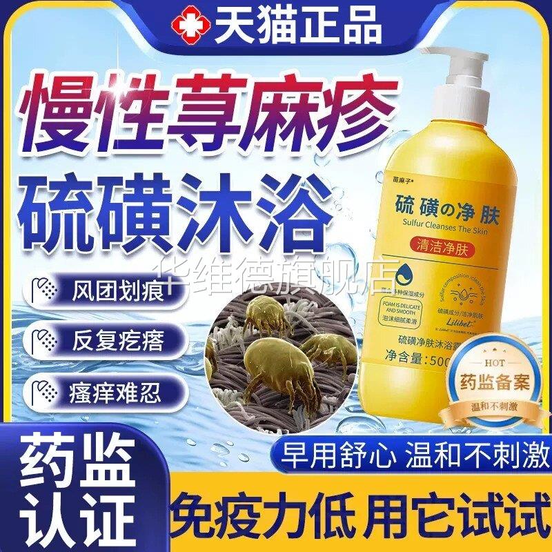 过敏性慢性胆碱性寻荨麻疹过敏止痒根提高免疫力止痒膏硫磺沐浴露