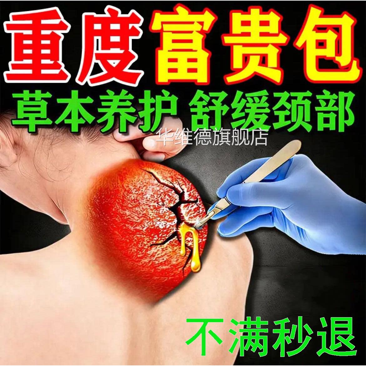 同仁堂富贵包疏颈椎压迫神经专用膏药头晕脖子鼓包淤堵通神热器敷