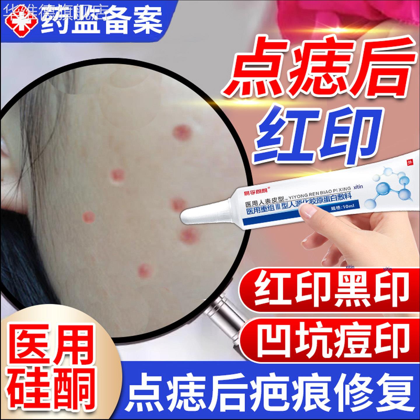 激光点斑祛痣点痣后去红印修覆膏退红淡印液去痣凹陷疤痕专用TT华