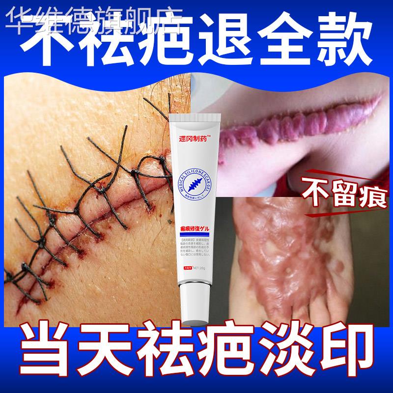 祛疤膏疤痕修覆除疤膏剖腹伤疤医用硅酮凝胶烫伤儿童增生凸起华维