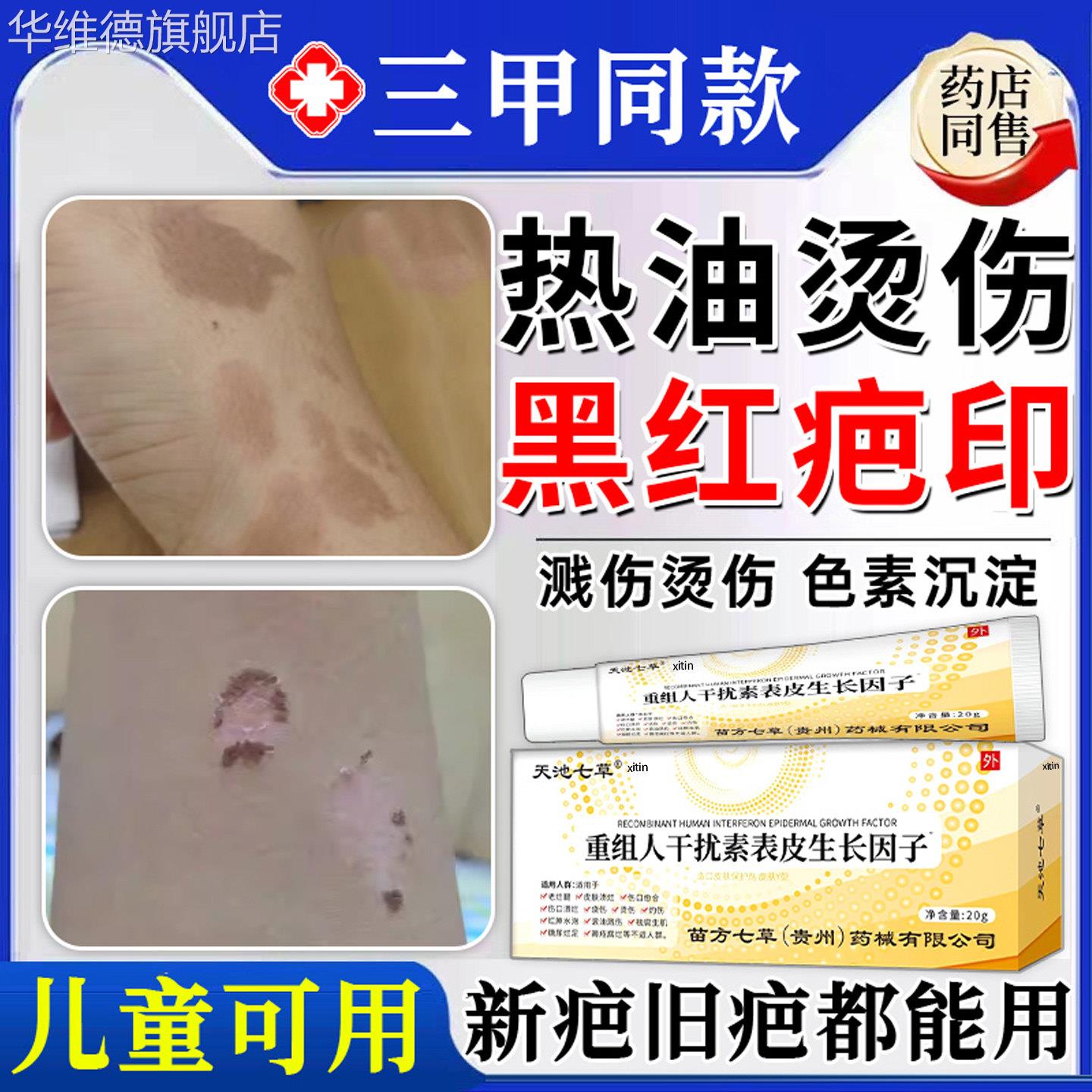 热油油烫伤烧伤去疤膏疤痕修覆除疤膏儿童祛去红印黑印色素沉淀TT