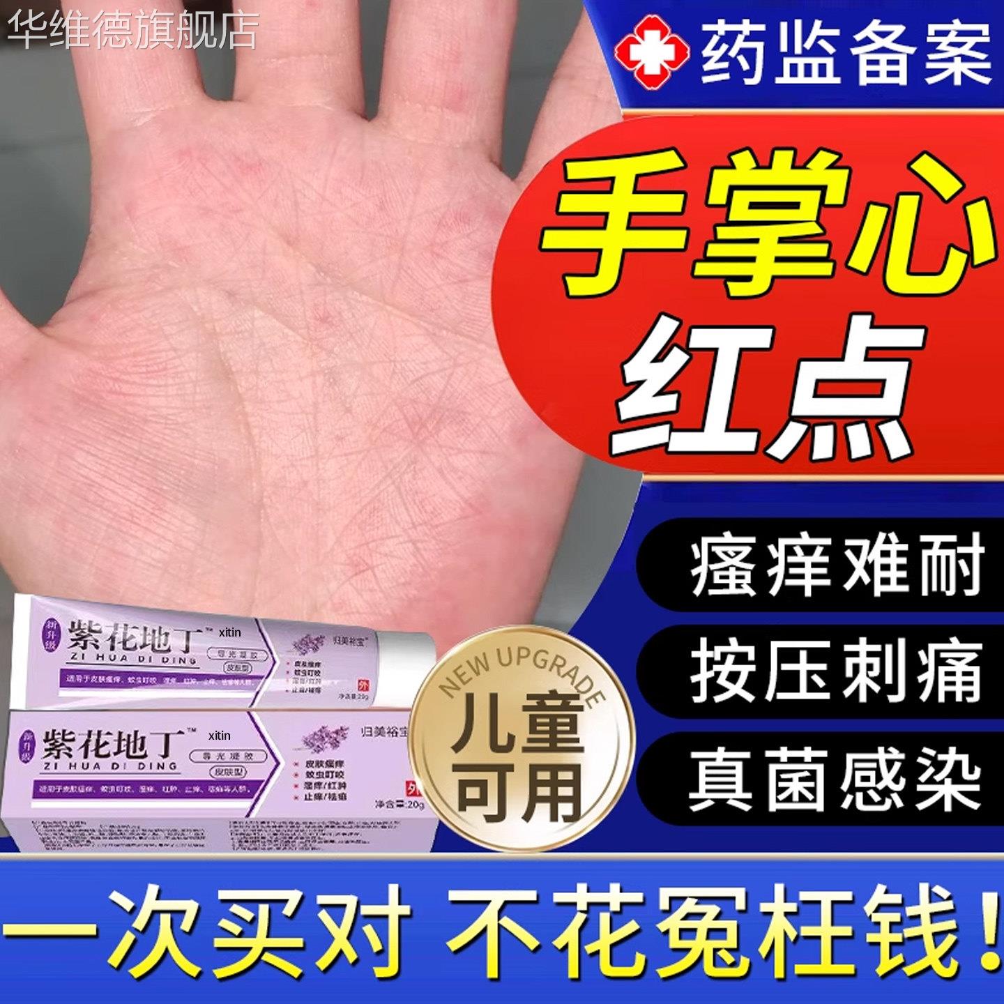 手心手掌红点瘙痒脱皮湿疹专用除湿止痒真菌感染手气水泡汗疱疹TT