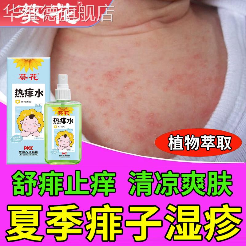 葵花痱子专用止痒去痱热痱子湿疹红疹根去成人儿童宝宝长热疹皮肤