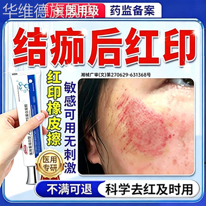 擦伤摔伤结痂后疤痕修复除疤膏去黑色素沉淀点痣去红印退红淡印FY