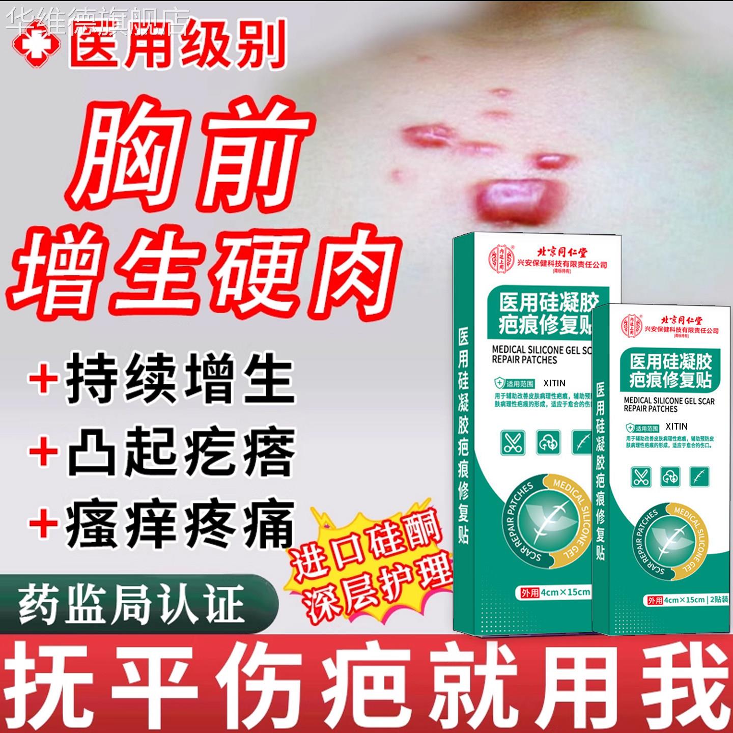 胸前痘痘疤痕增生凸起去除疙瘩贴止痒去祛疤贴隐形压力贴修复TT华