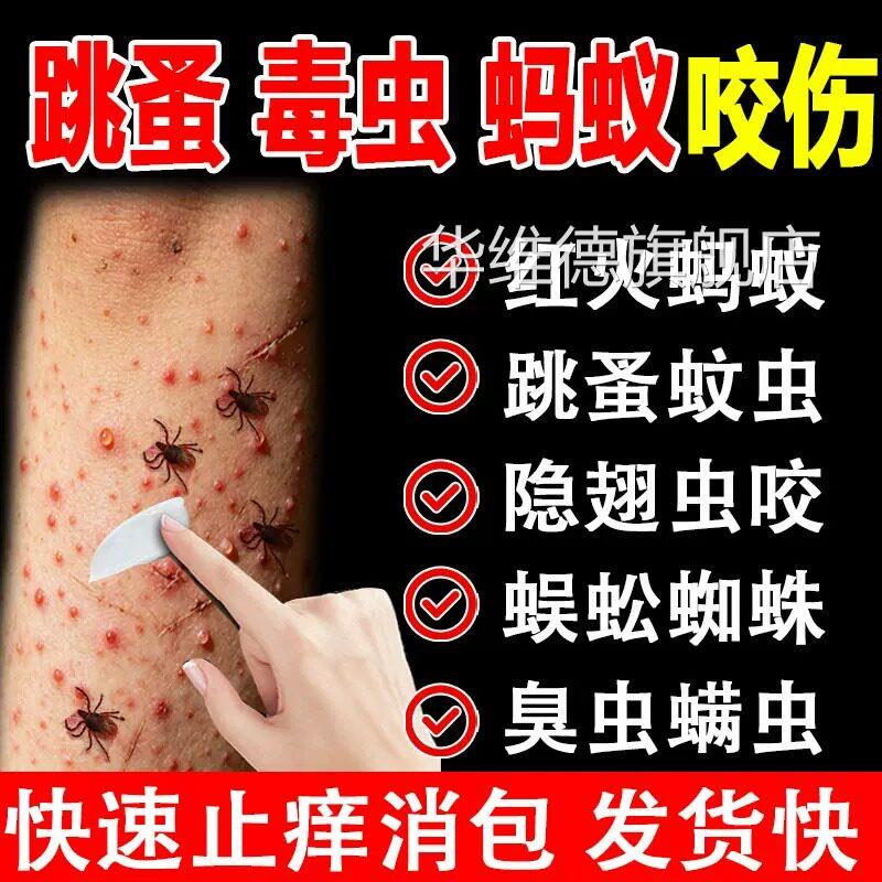 跳蚤咬止痒膏红肿用蚂蚁咬伤膏消肿成蚊虫叮咬人儿童正品官方华维