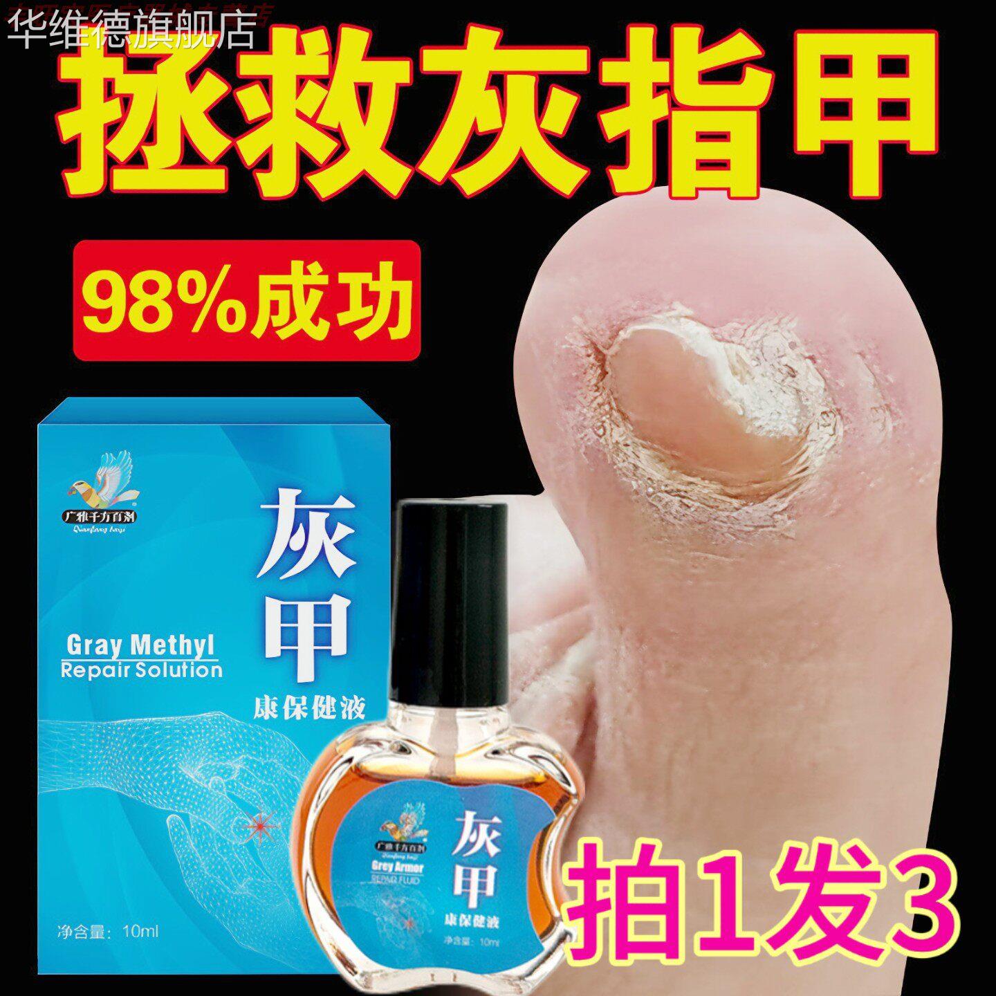 3瓶20元】灰甲康保健液治指甲抑菌炎疗嵌甲镇痛甲沟增厚药店同款