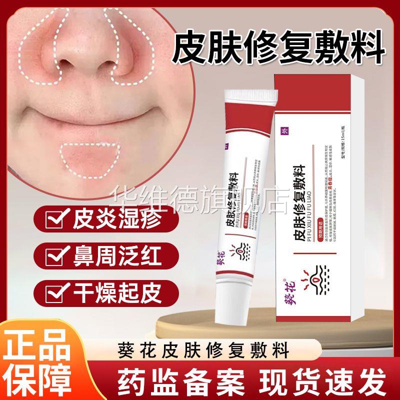医用皮肤修复敷料鼻子两边干燥起皮鼻翼两侧发红脱皮泛红瘙痒皮炎