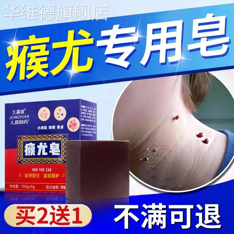 丝状疣肉粒去除神器脖子上长小肉粒疙瘩皮赘扁平疣面颈部专用香皂