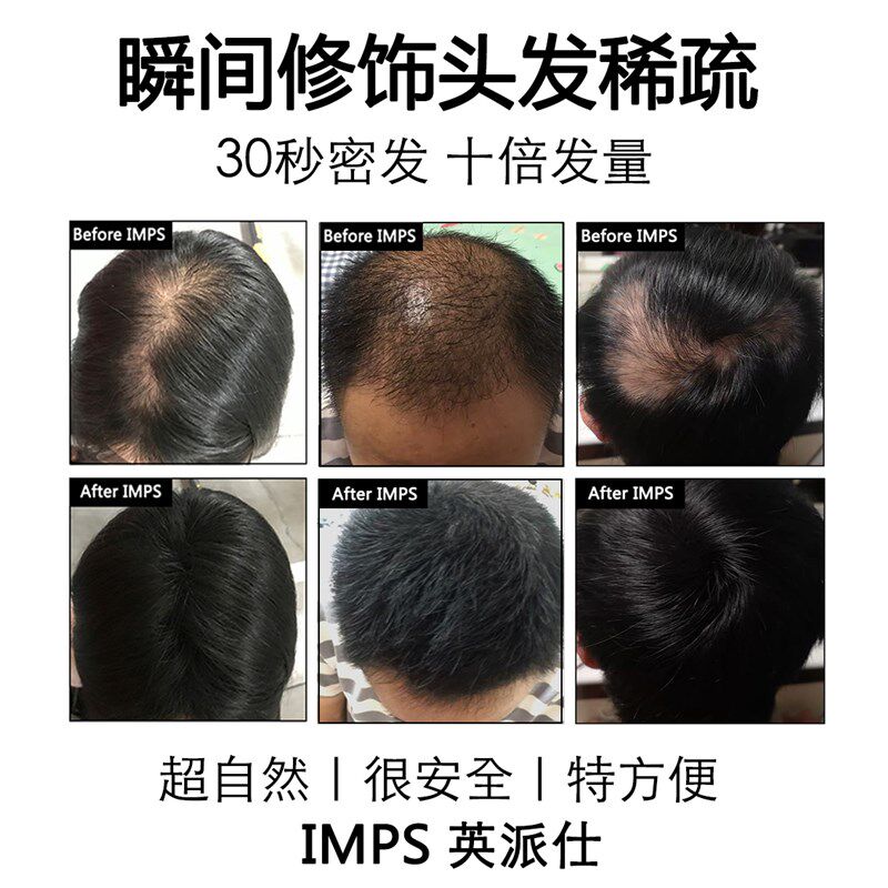 头发纤维粉增发密发补发神器假发粉发际线填充浓密增多遮盖稀少