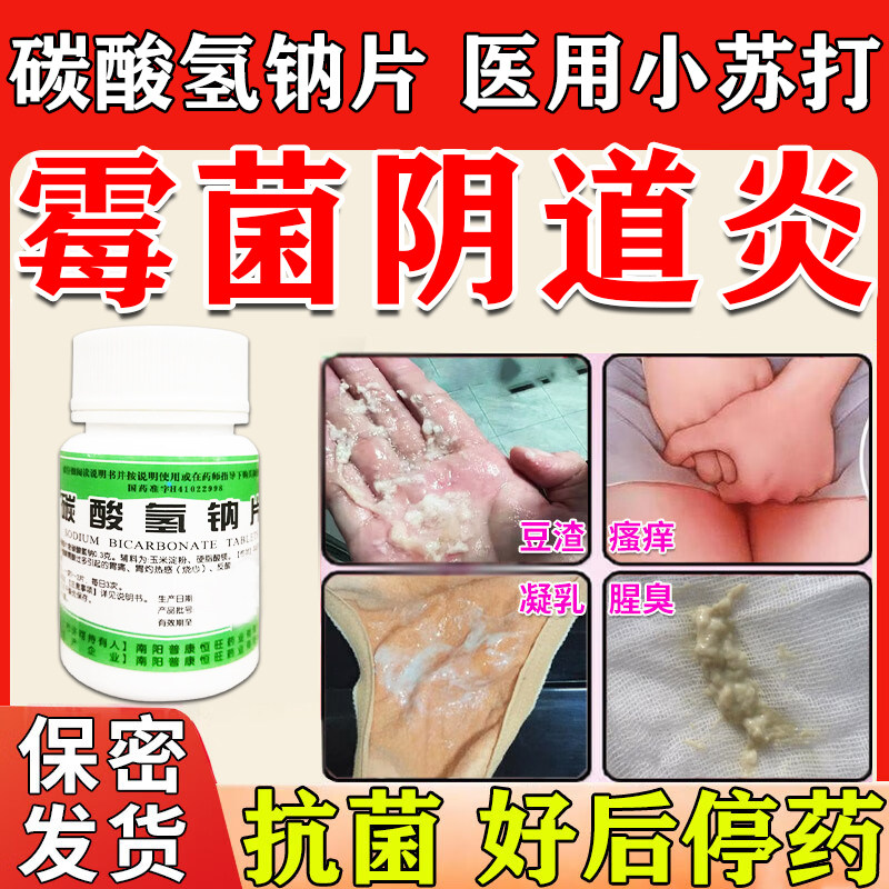 碳酸氢钠片100片妇科霉菌性阴道炎妇科专用药医用小苏打止痒抑菌