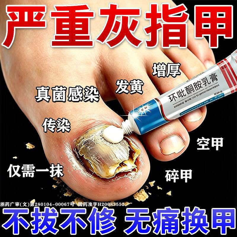 [金归]环吡酮胺乳膏1%*20g*2支/盒