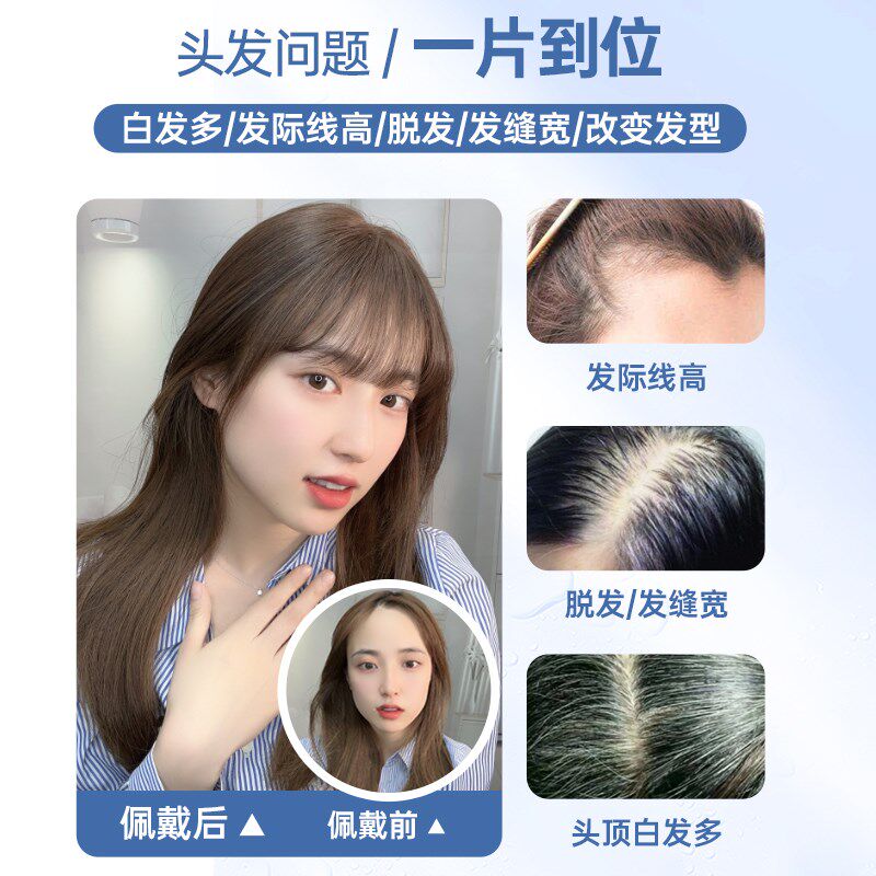 瑞家mono网假发女片头顶夏天薄款补发真发增发量蓬松高颅顶辫子发