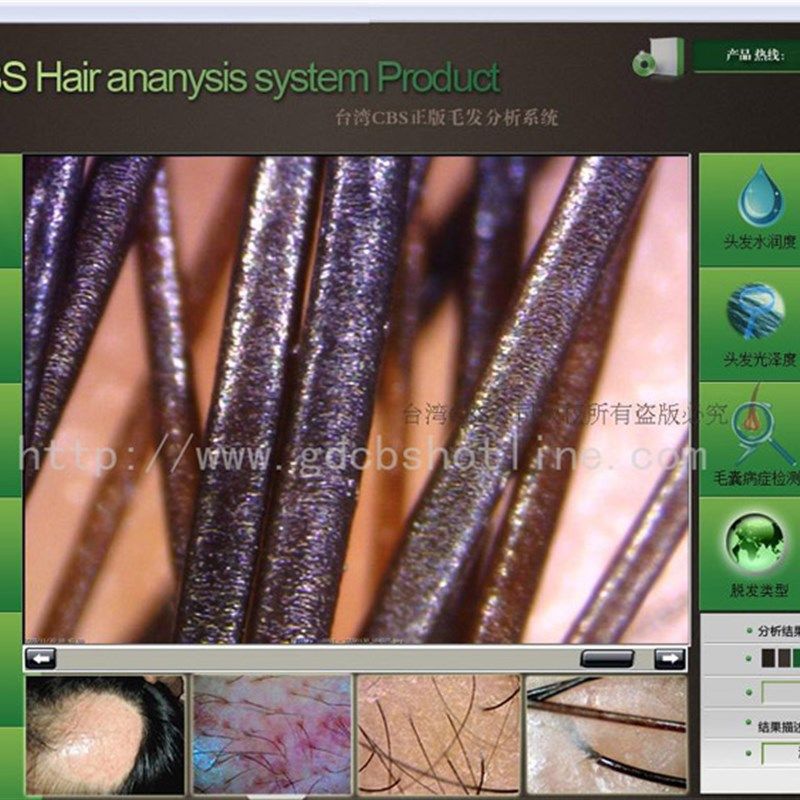 便携式毛发镜水润度弹性皮肤测试仪毛囊分析仪头皮检测仪