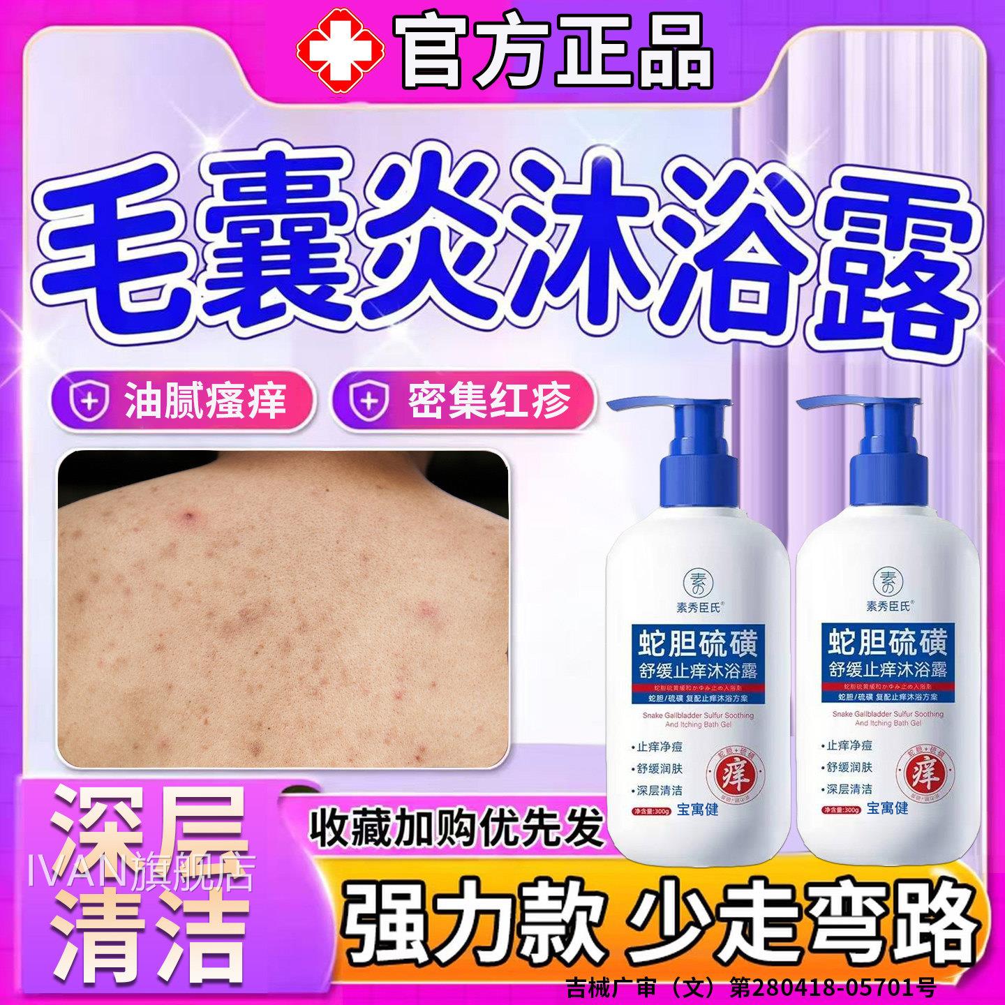 前胸后背毛囊炎去除背上长痘色痘沐浴露马拉菌除螨祛痘痒手臂疙瘩