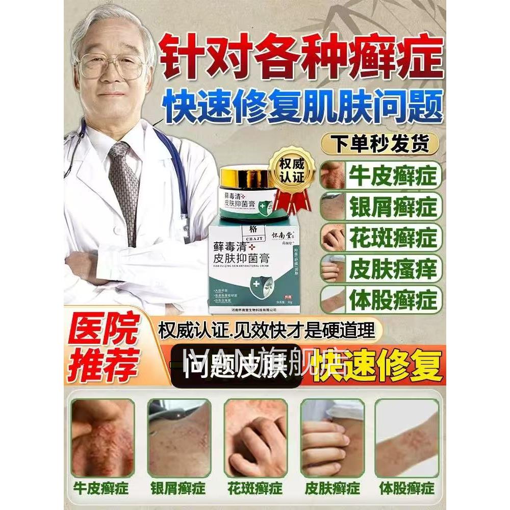 牛皮癣药膏汗斑花斑银1屑病红肿皮肤瘙1痒止11痒外用的特1效药膏I
