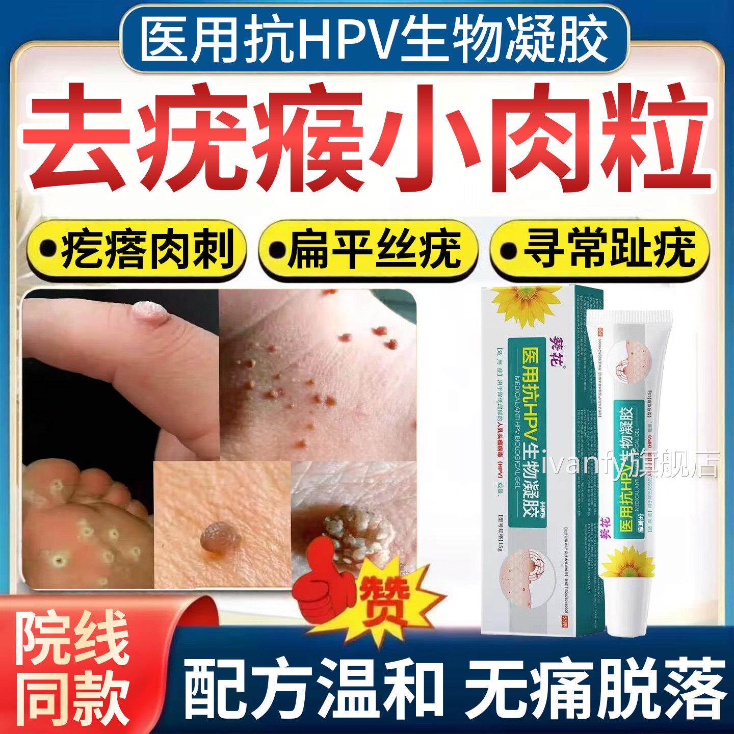 去疣膏斩草除根医用级去猴子肉粒疙瘩肉刺疣瘊去祛除神器子一抹灵
