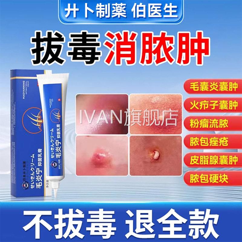 疖肿断痒拔疖毒膏火子的囊肿痛脓包皮脂腺痘痘痒私处外阴囊毛囊炎