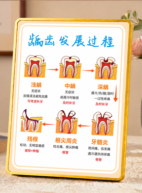 口腔诊所龋齿发展过程科普知识展示牌牙科诊室创意装饰摆件