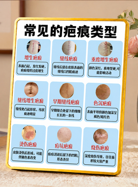 美容院常见疤痕类型知识展示台卡养生馆装饰摆件提示牌