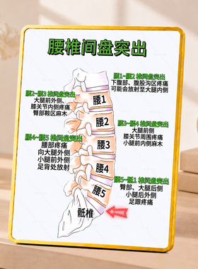 腰椎间盘突出知识科普装饰摆件中医馆养生馆诊所桌面展示牌