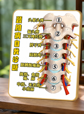 颈椎病自我诊断图解装饰摆件中医养生馆理疗馆桌面提示摆台
