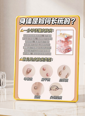 皮肤疣成因区分科普引流摆件