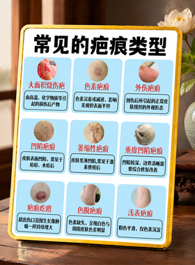 美容院常见疤痕类型科普展示摆件养生馆皮肤管理宣传装饰摆台
