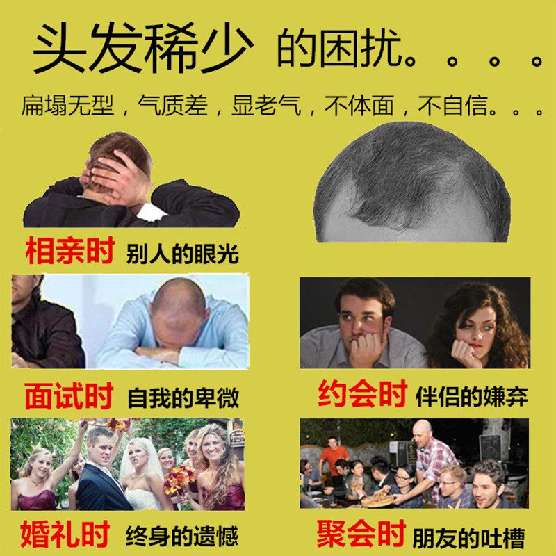 dexe英国版头发纤维粉增发际线补发神器头顶稀发遮盖快速植发假发