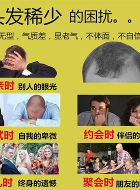 dexe英国版头发纤维粉增发际线补发神器头顶稀发遮盖快速植发假发
