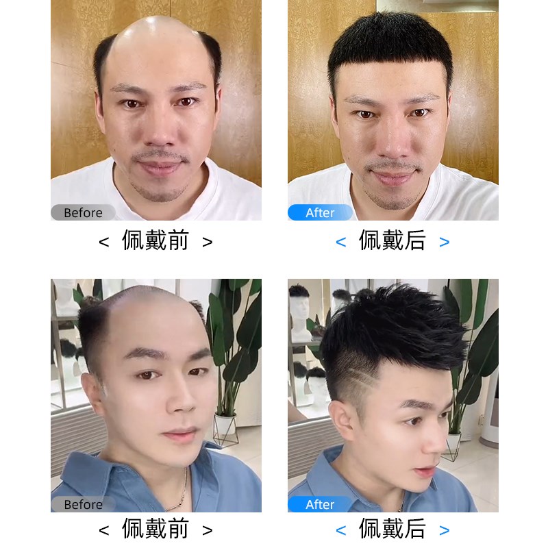 假发男短发全手织头顶补发片假发片全真人发丝轻透气递针生物头皮