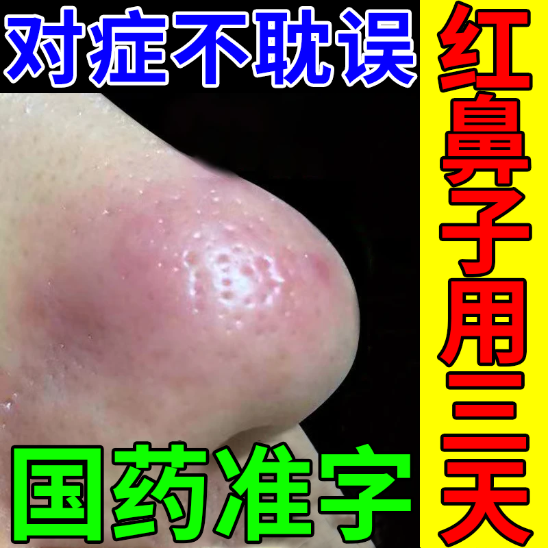 [顺峰]维生素B6软膏1.2%*10g*1支/盒