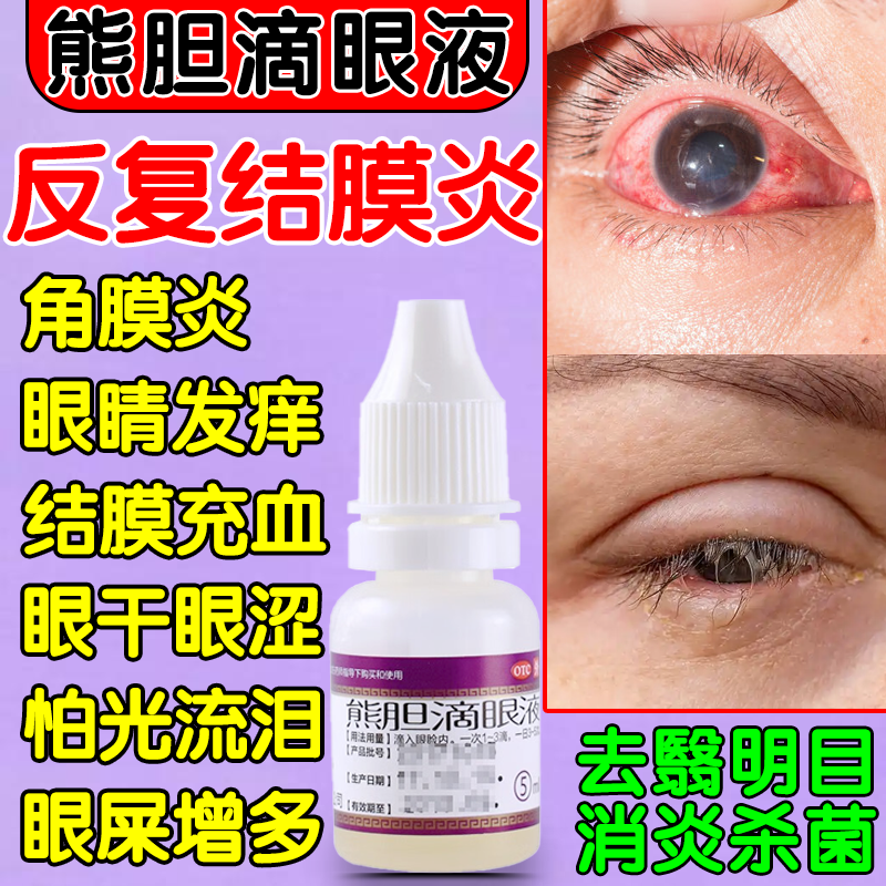 熊胆明目滴眼液结膜炎眼药水止痒消炎杀菌眼睛干涩缓解视疲劳s