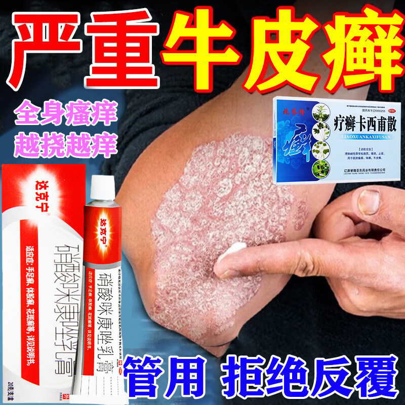 牛皮癣特专用药皮肤用药牛皮癣药膏真菌感染止痒抑菌皮肤股癣效s