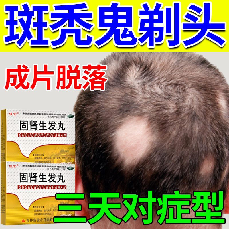 固肾生发丸斑秃特秃效药治疗脱发掉头生发调理肾虚型脱发头发s