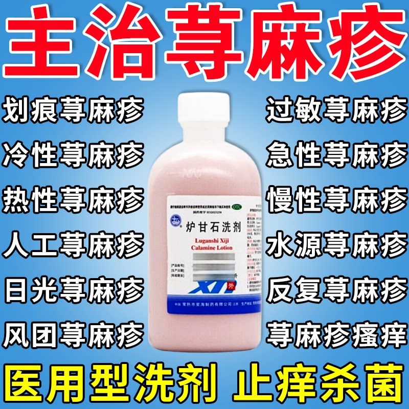 炉甘石洗剂寻荨麻疹过敏止痒断专用药根止痒抑菌皮肤瘙痒特疗S